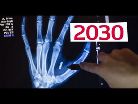 rfid chips 2020|microchip implantation by the end of 2020.